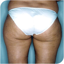 Apercu de la vignette