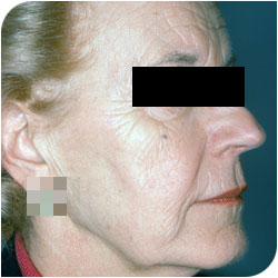 Apercu de la vignette