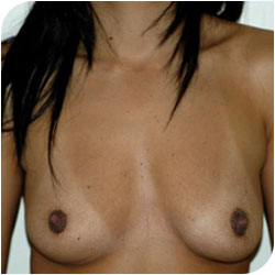 Apercu de la vignette